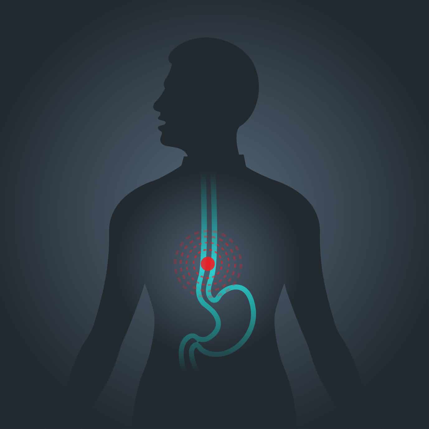 infection chirurgie digestive btlv.fr